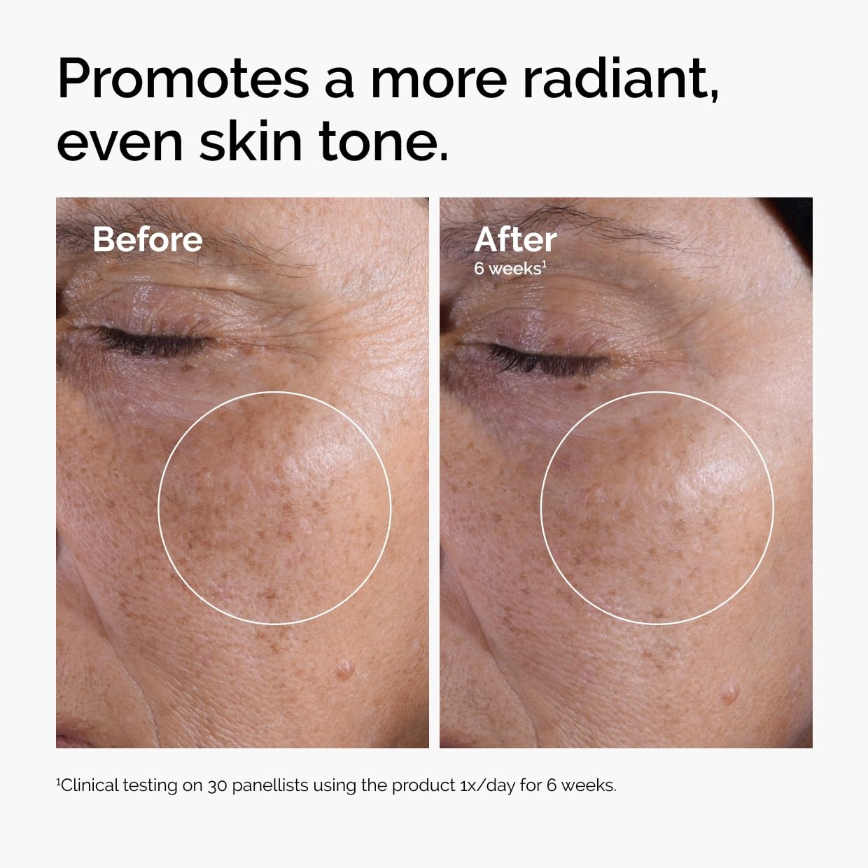 image:imageThe Ordinary Glycolic Acid 7 Exfoliating Toner Brightening and Smoothing Daily Toner for More EvenLooking Skin Tone34 Fl Oz Pack of 2