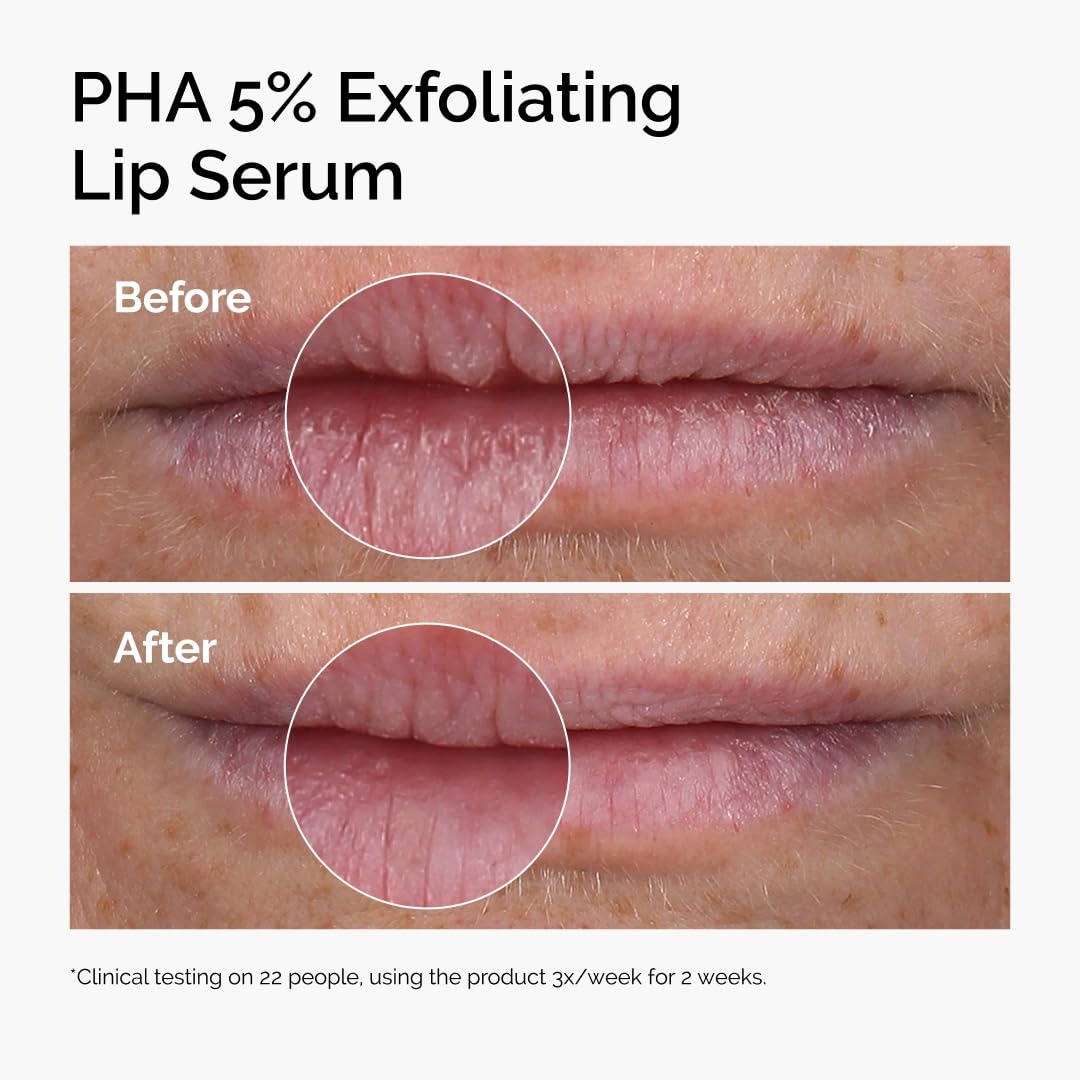 image:imageThe Ordinary Lip Care Duo Skin Care Bundle Set PHA 5 Exfoliating Lip Serum 05 Fl Oz Squalane and Amino Acids Lip Balm