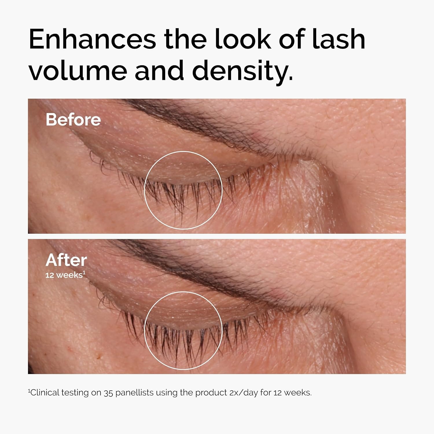 image:imageThe Ordinary MultiPeptide Lash and Brow Serum PeptidePowered Formula for Thicker Fuller Looking Lashes amp Brows016 Fl Oz Pack of 2