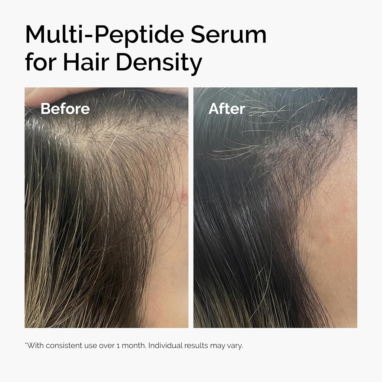 image:imageThe Ordinary MultiPeptide Serum for Hair Density PeptidePowered Formula for Thicker Fuller Looking Hair202 Fl Oz Pack of 1