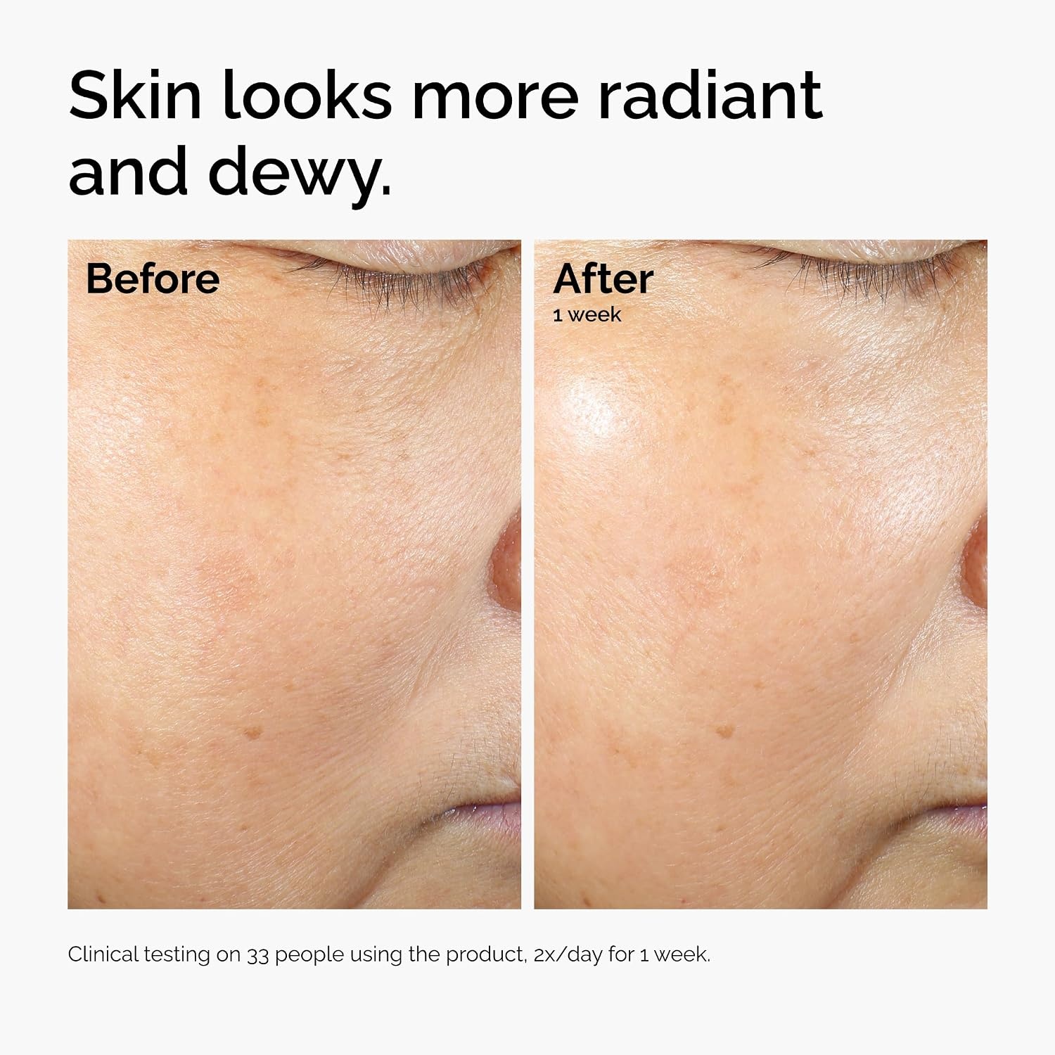 image:imageThe Ordinary Rice Lipids Ectoin Microemulsion Moisturizer for Dry Skin Soothing Hydration Barrier Repair Reduced Redness2 Fl Oz Pack of 1