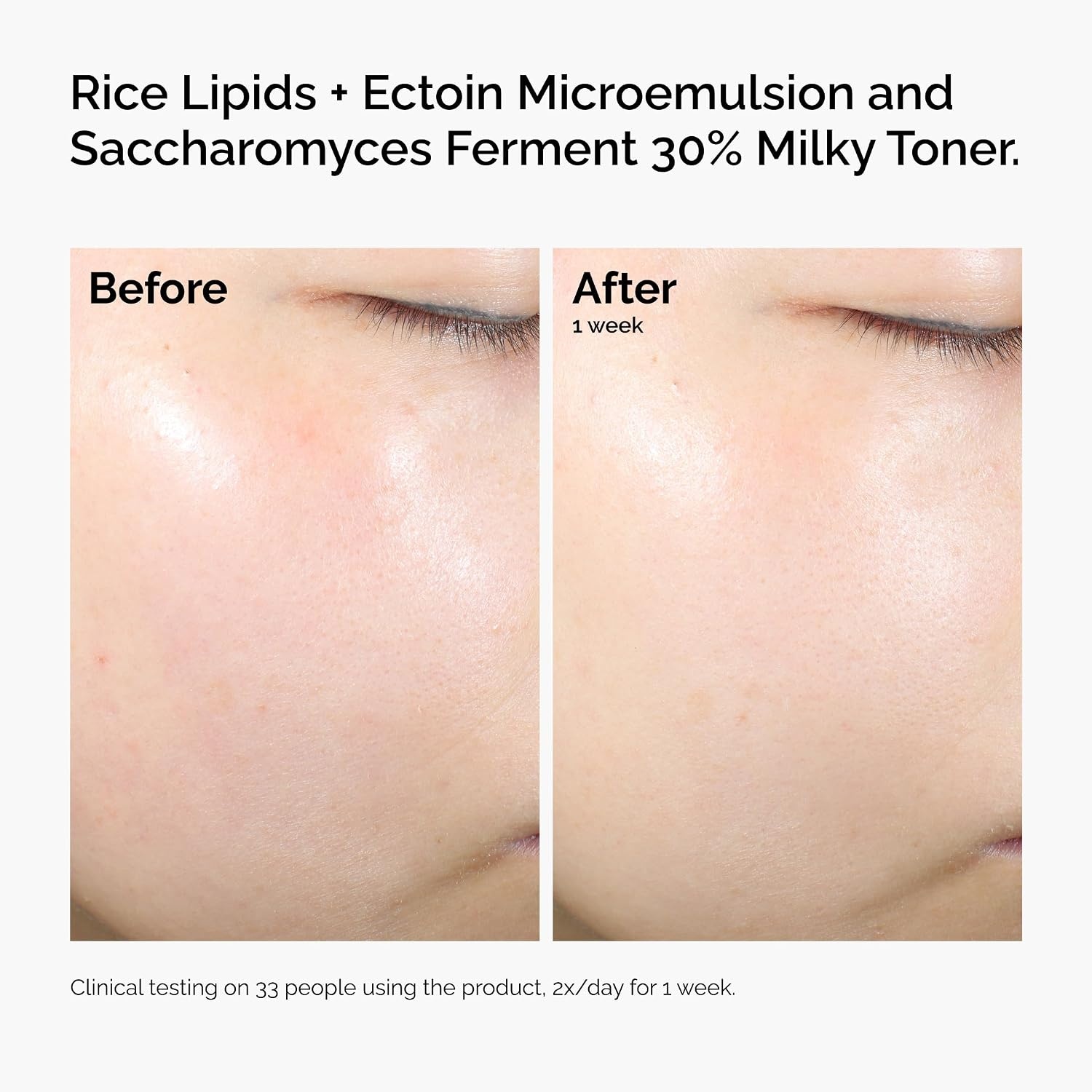 image:imageThe Ordinary Rice Lipids Ectoin Microemulsion Moisturizer for Dry Skin Soothing Hydration Barrier Repair Reduced Redness2 Fl Oz Pack of 1