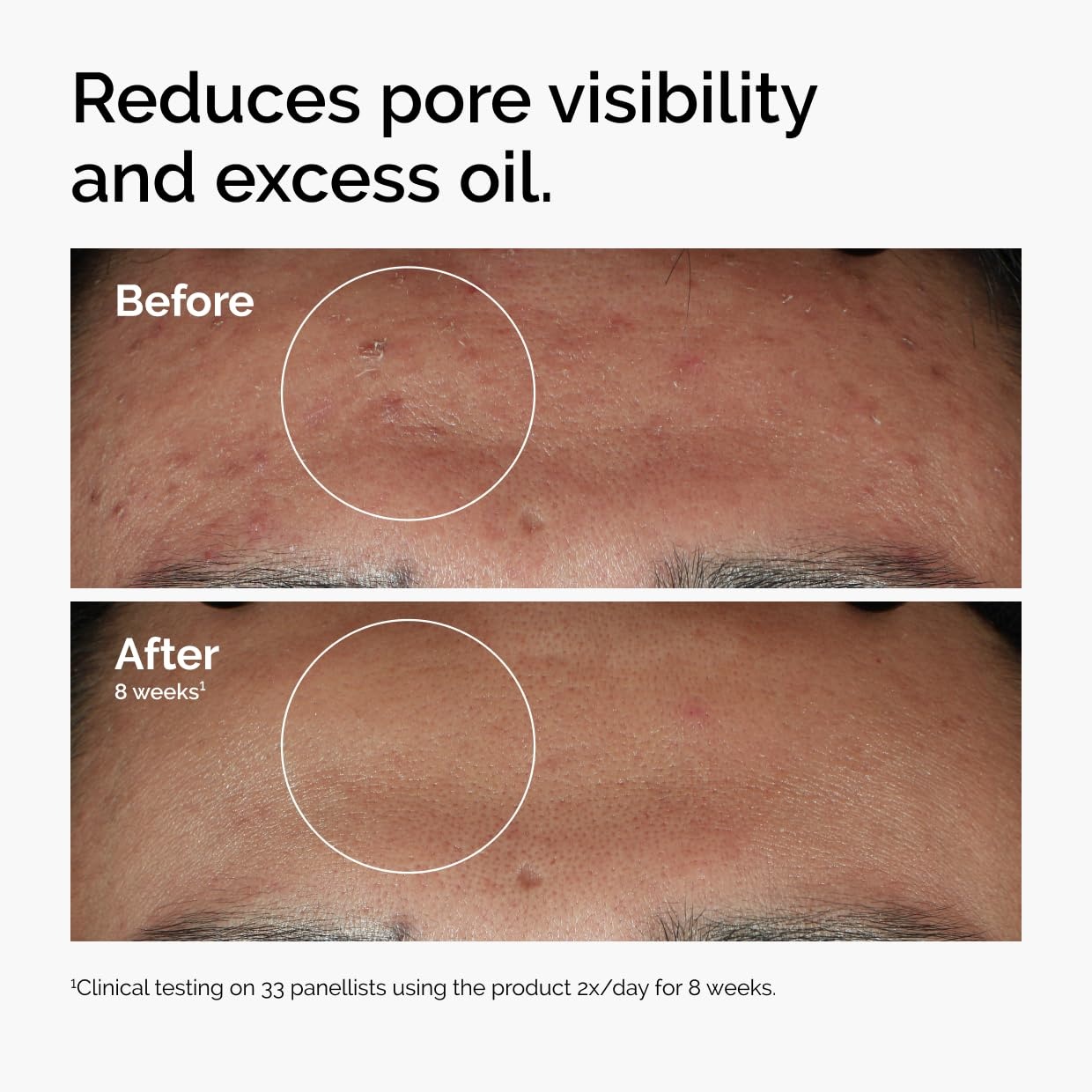 image:imageThe Ordinary The Mini Icons Set Travel Size Skin Care to Hydrate and Brighten Glycolic Acid 7 Exfoliating Toner Niacinamide 10 Zinc 1 Hyaluronic Acid 2 B5 4 Reusable Rounds