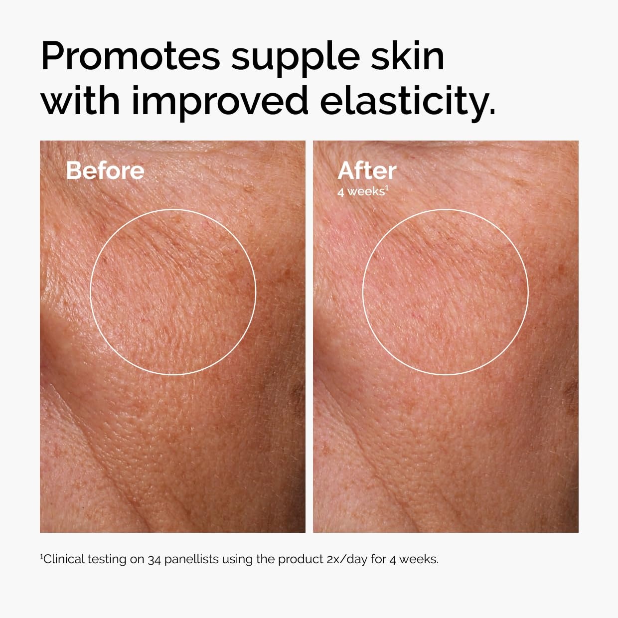 image:imageThe Ordinary The Mini Icons Set Travel Size Skin Care to Hydrate and Brighten Glycolic Acid 7 Exfoliating Toner Niacinamide 10 Zinc 1 Hyaluronic Acid 2 B5 4 Reusable Rounds