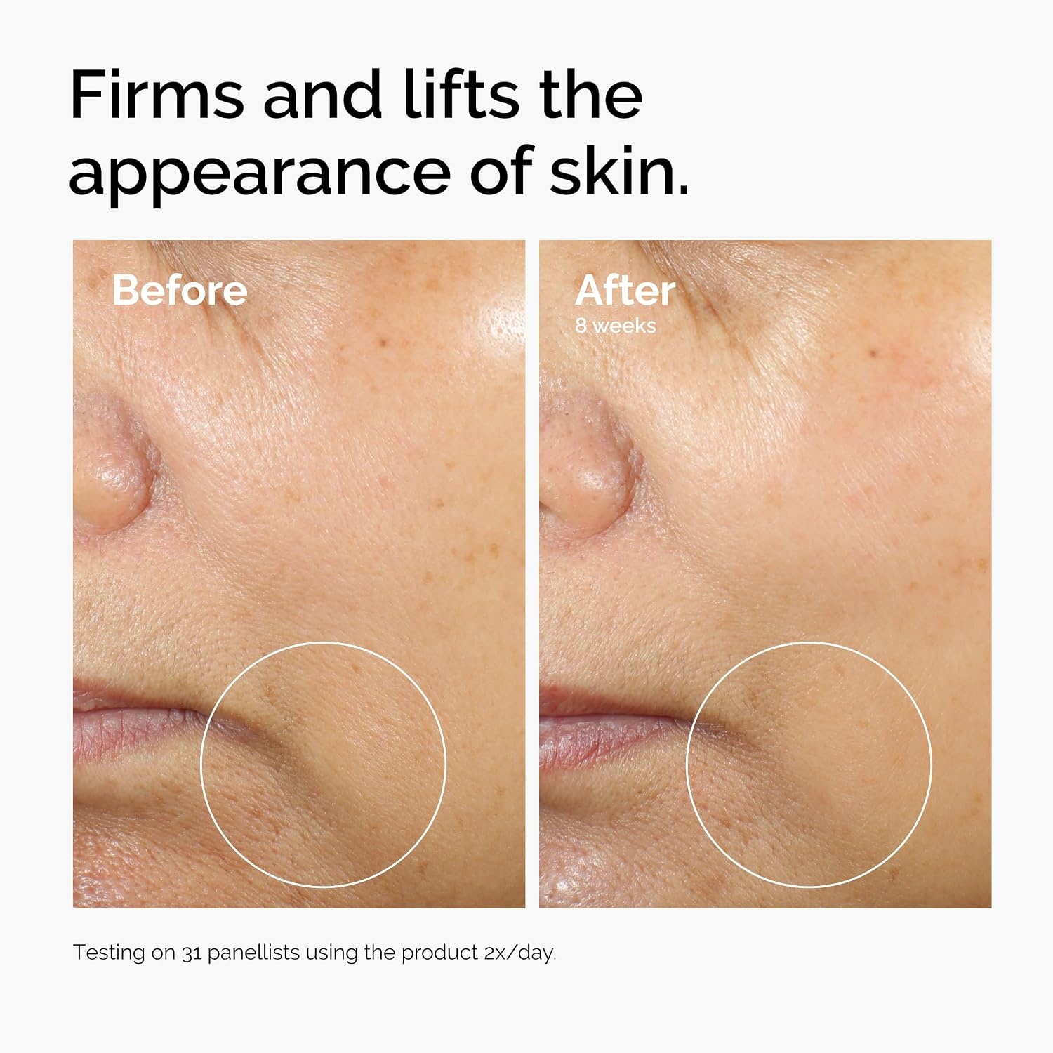 image:imageThe Ordinary Caffeine 3 Escin 1 Face Serum Energizing Serum to Tone and Tighten 1 Fl Oz