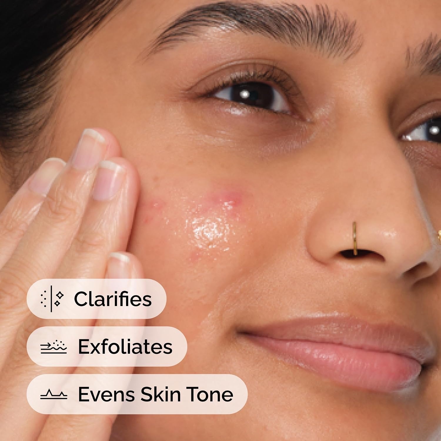image:imageThe Ordinary Salicylic Acid 2 Anhydrous Solution Gentle Exfoliating Serum for BlemishProne Skin and Uneven Texture1 Fl Oz Pack of 1